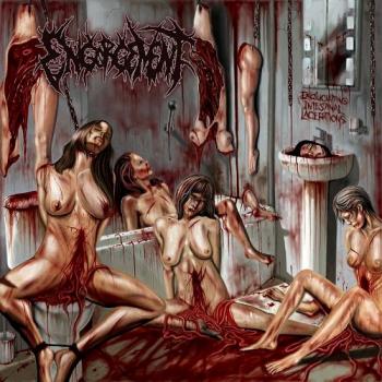 Engorgement - Excruciating Intestinal Lacerations