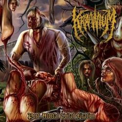 Kraanium - Post Mortal Coital Fixation